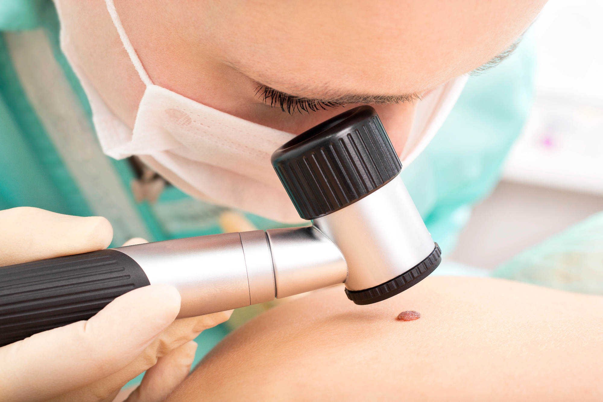 Tudi dermatologija Koper nima čakalnih vrst